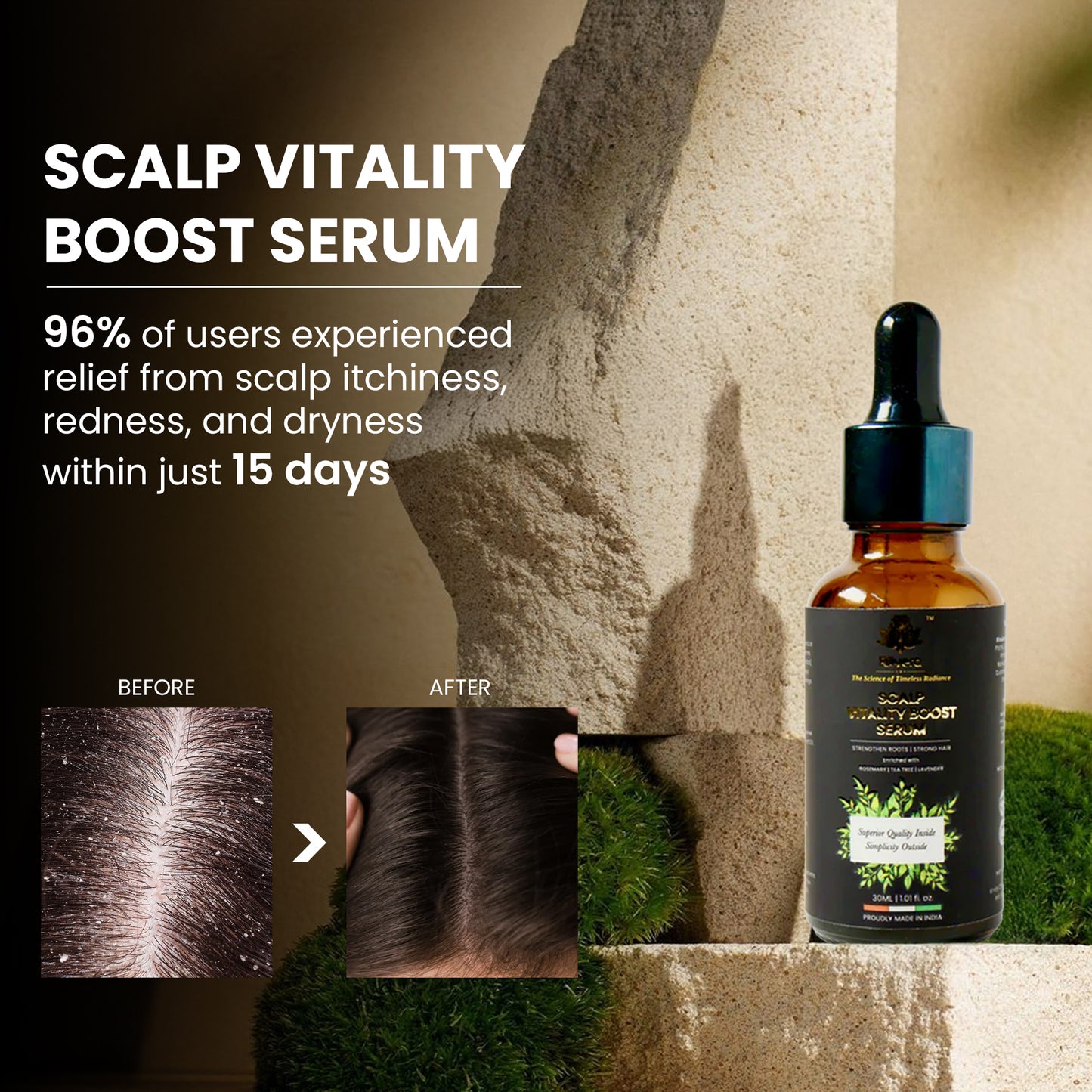Scalp Vitality Boost Serum | Nourishes Scalp |Strengthens Roots| Reduces Hair Fall| Hair Growth & Shine Formula.